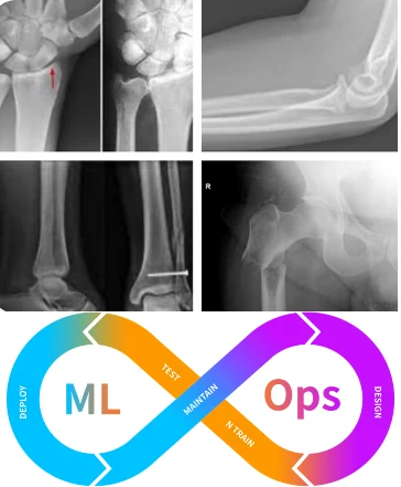 MLOps Pipeline for Bone Fracture Classification & Deployment on Cloud Platforms — research illustration